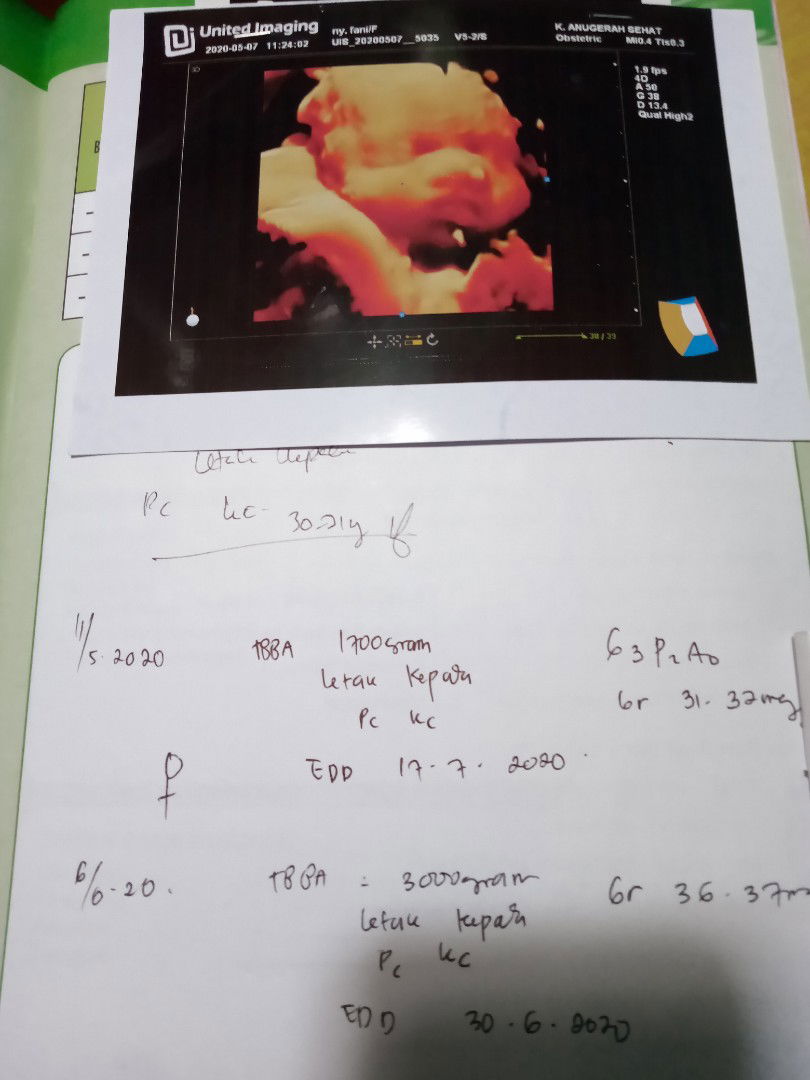 HPL berubah terus????