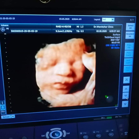 แม่ๆช่วยตั้งชื่อลูกหน่อยค่ะ