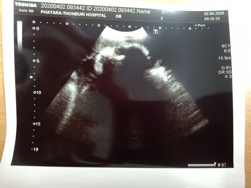 อยากเจอแล้ว