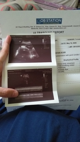 Ultrasound