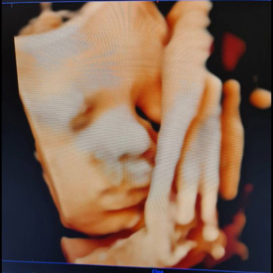 36W2D น้องหนักแค่ 2,190 เองค่ะ