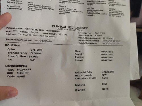 May UTI po ba ako?