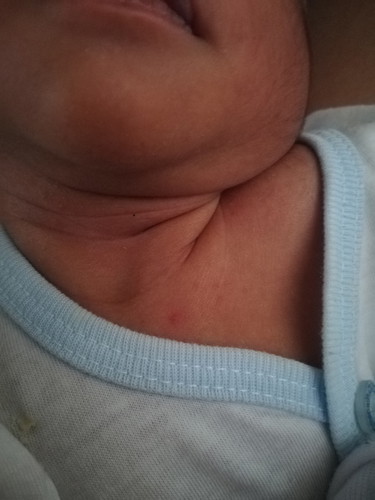 Insect Bite Or Rashes?