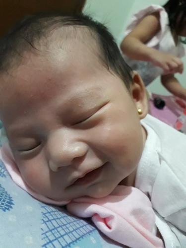 24DAYS OLD RASHES SA FACE