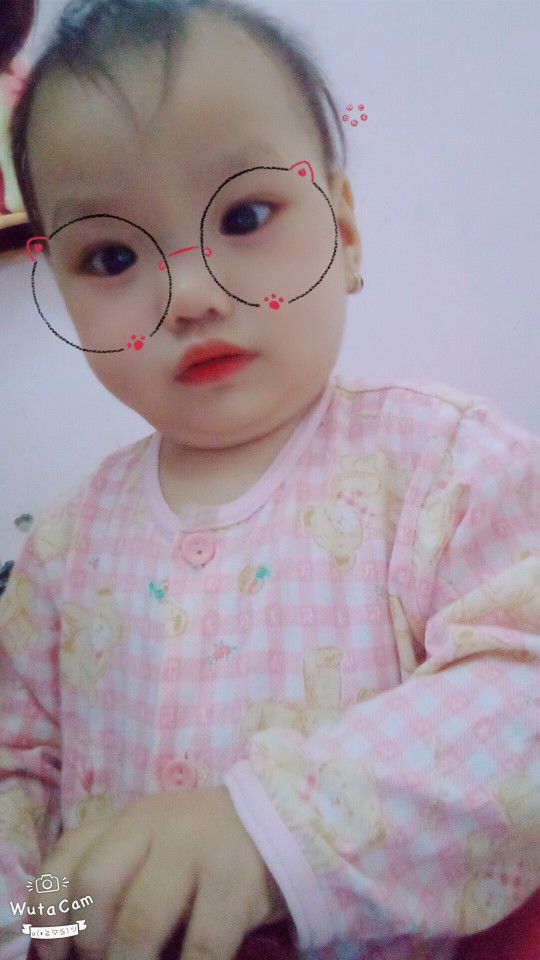 mom nào sinh mổ xong mà muốn k để lại sẹo thì cm bên dưới e chỉ cho cách nhé