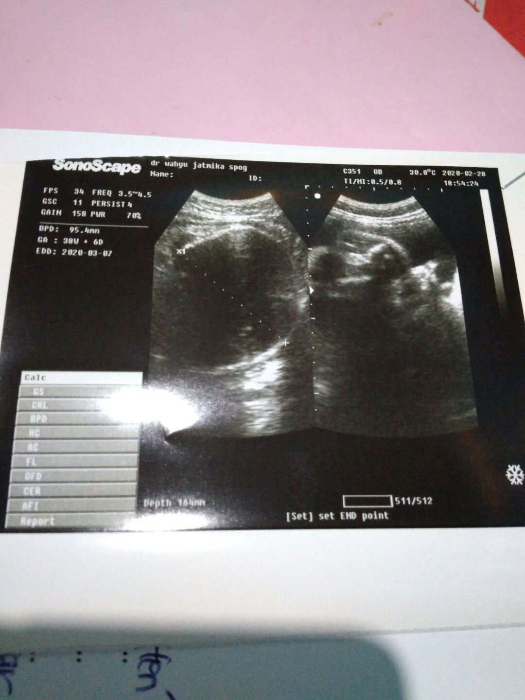 lupa tanggal haid terakhir