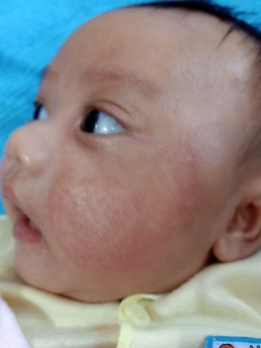 ini apa ya penyebabny dan pakai apa ya obat nya