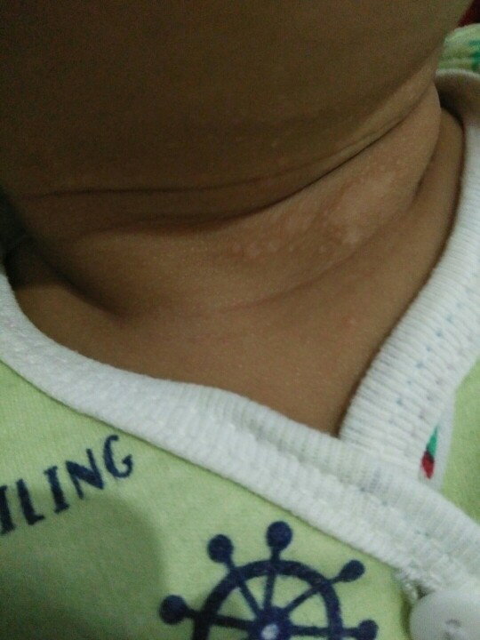 bintik putih