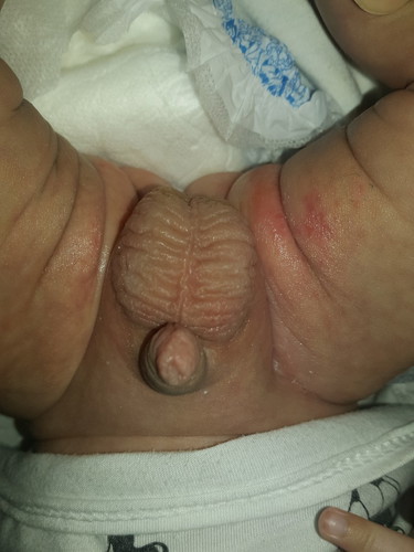 Rashes