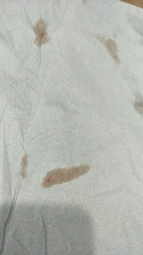 flek coklat muda usia 3w6d