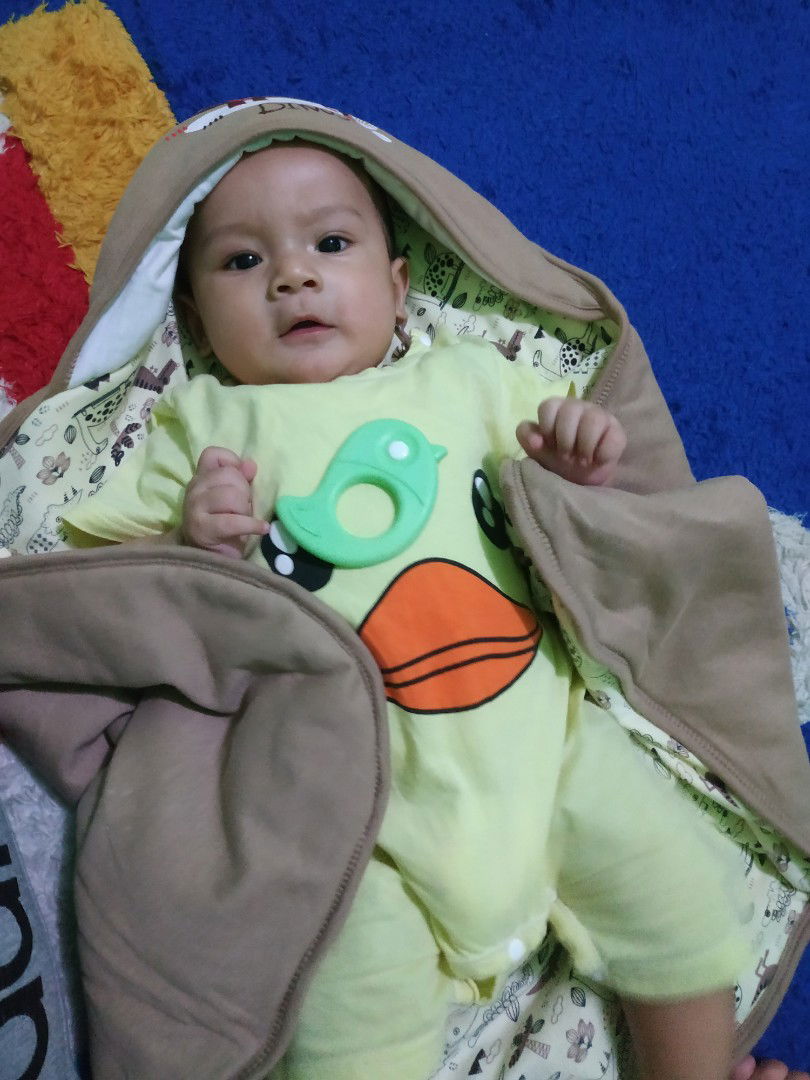 adanya kantung mata pada bayi