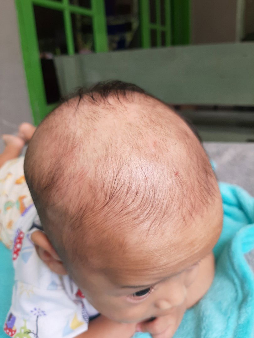 rambut bayi ga tumbuh juga