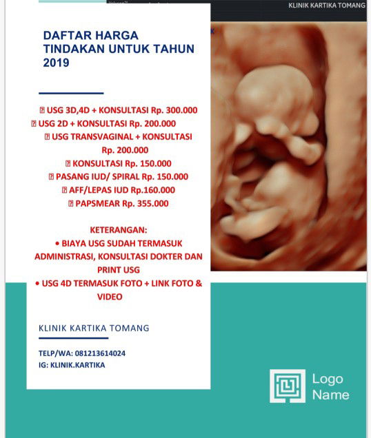 Sekedar Info Untuk USG 4D