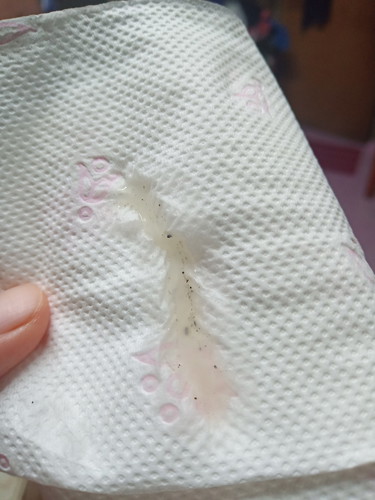 discharge or something else?