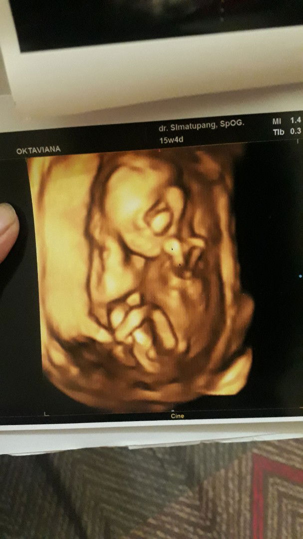 baby boy or girl?