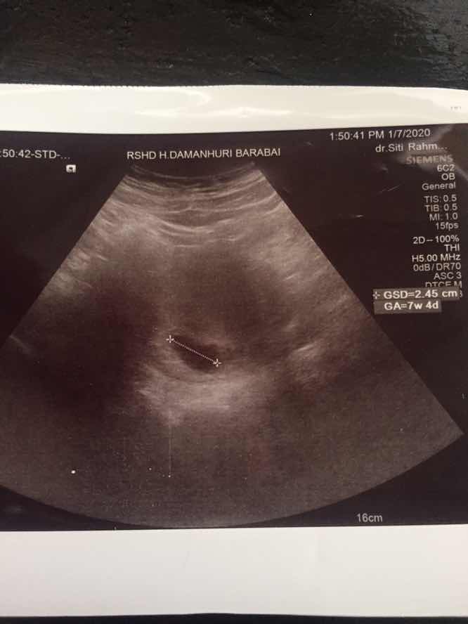 Sharing kehamilan pertama