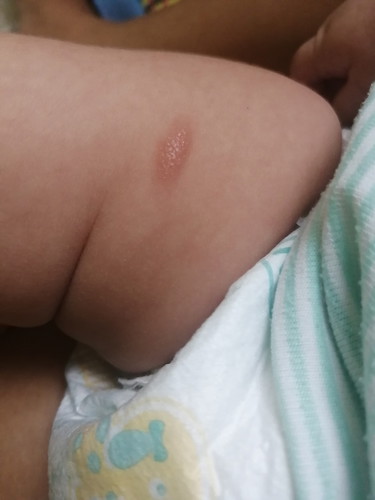 skin problem