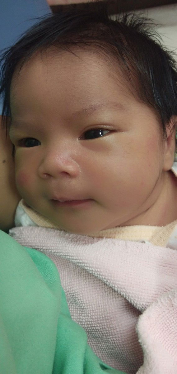 ผมดกไปไหนลูก