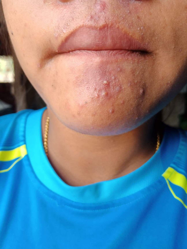 โทรมตอนท้องแก่