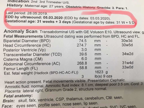 สอบถามเเม่ๆหน่อยจ้า กรณีเปลี่ยนจากรพนึงไปคลอดอีกที่นึงค่ะ