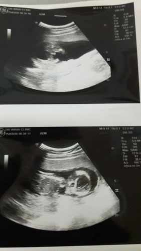 ผช.หรือผญ.คะ