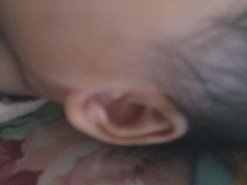 telinga gepeng seblah