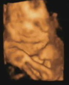 4D ULTRASOUND AT 29 WEEKS