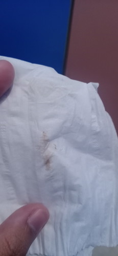 ตกขาวสีน้ำตาล