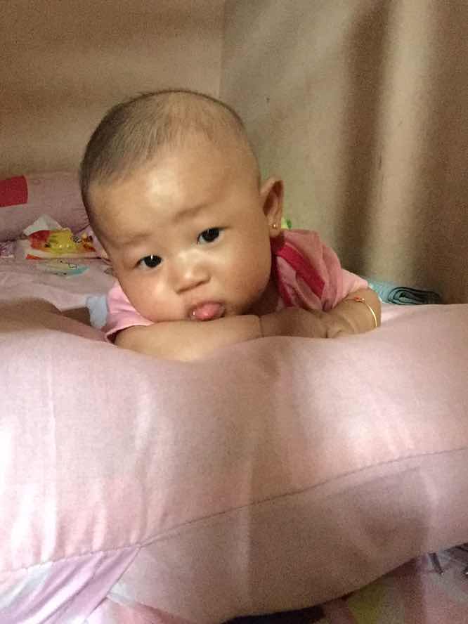 Kepala tengok kanan terus