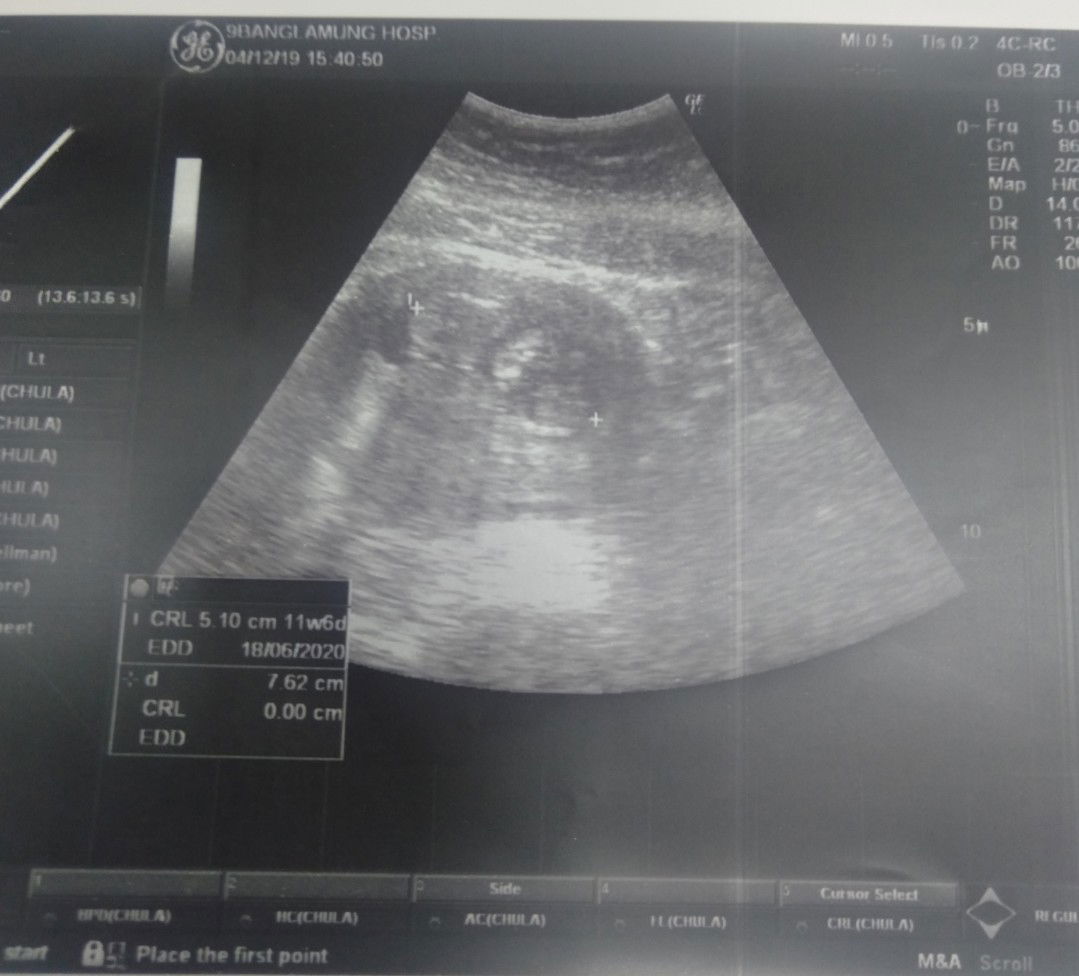 Juthathip Noisuk profile icon