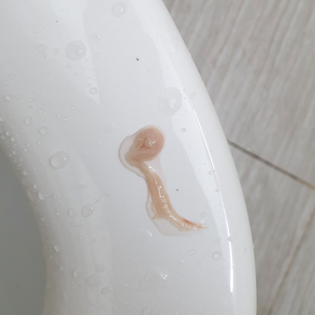 dịch nhầy màu hồng là báo hiệu gì các mẹ ơi