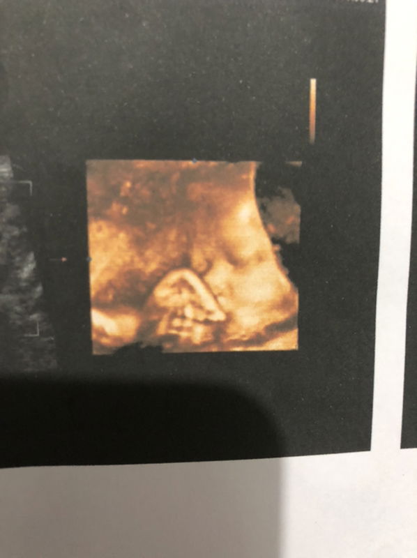 Chadatan Pormsorn profile icon