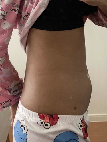 ขอดูรูปท้องแม่ ทีมกรกฎาหน่อยค้าา ท้องโตกันรึยังคะ