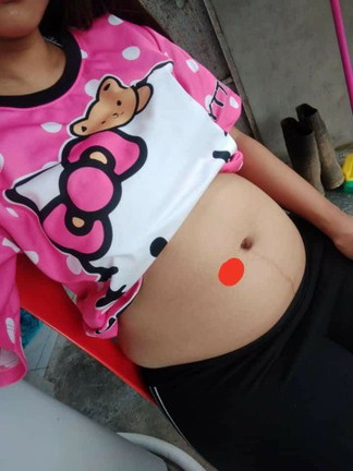 เจ็บท้องจี๊ดๆ
