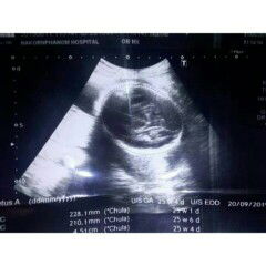 ภาพซาวของคุณแม่คนไหนเป็นแบบนี้บ้าง