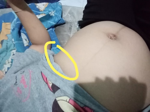 ท้อง