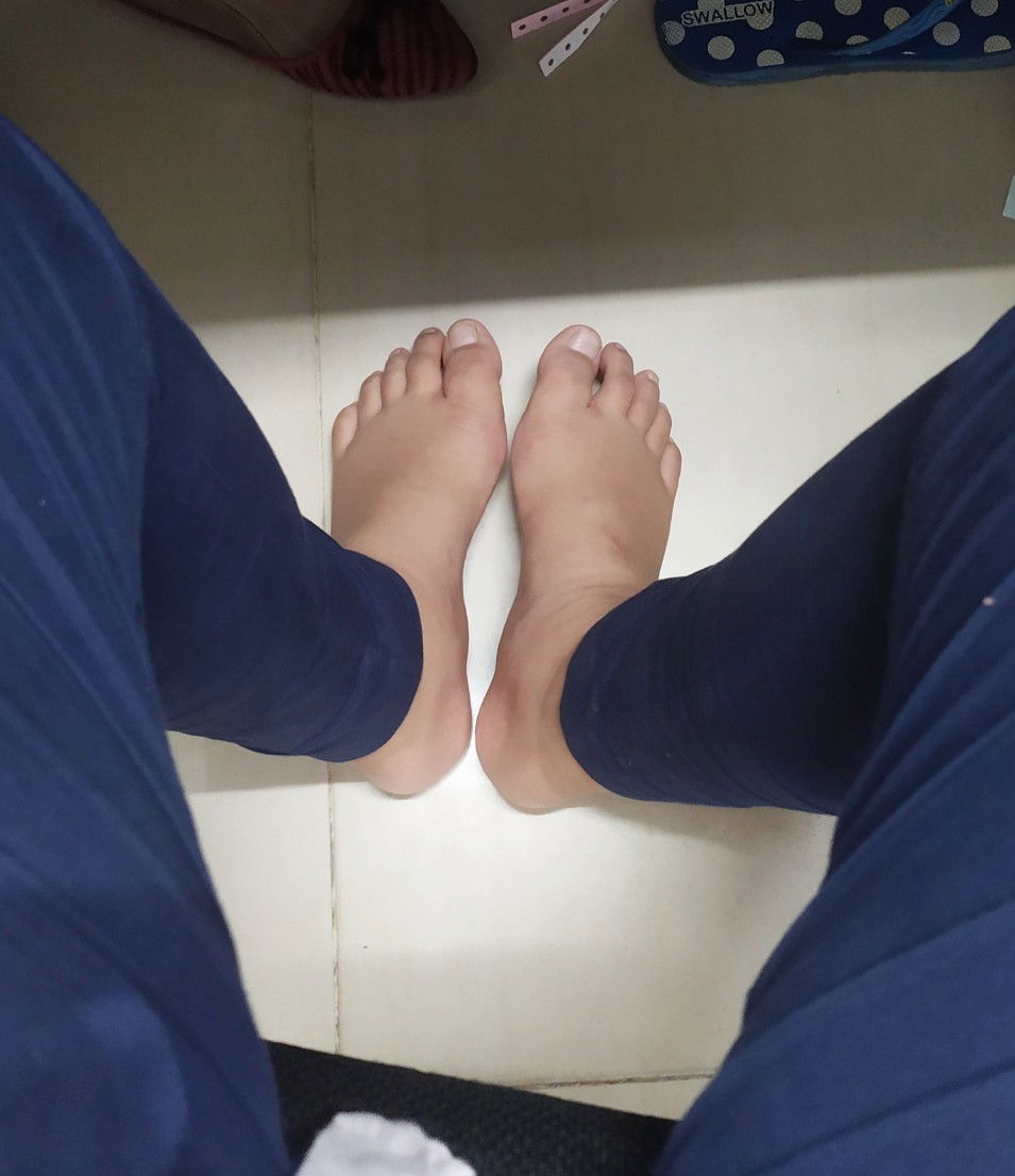 kaki bengkak trimester 3