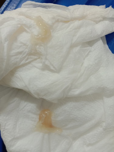 แม่ๆๆบ้านไหนรู้บ้างคะ