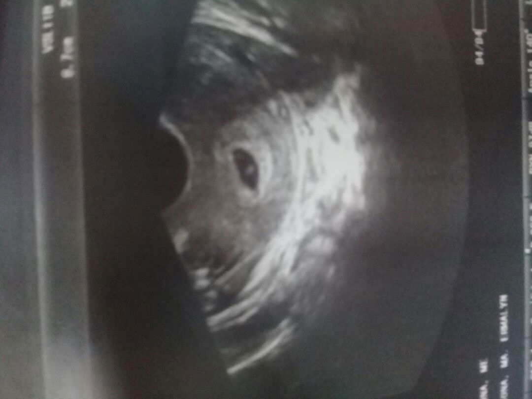 doubt my last period