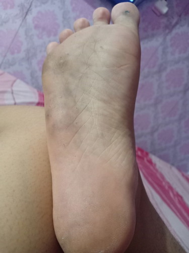 ada yang kakinya pada begini gak