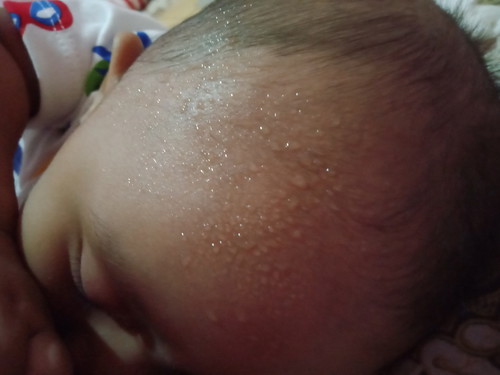 bayi berkeringat di kepala