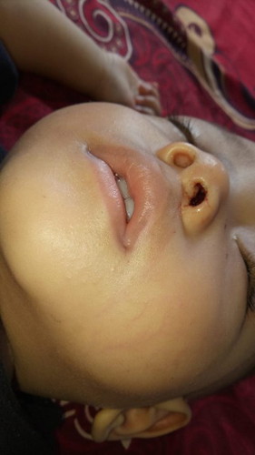 anak mimisan saat tidur