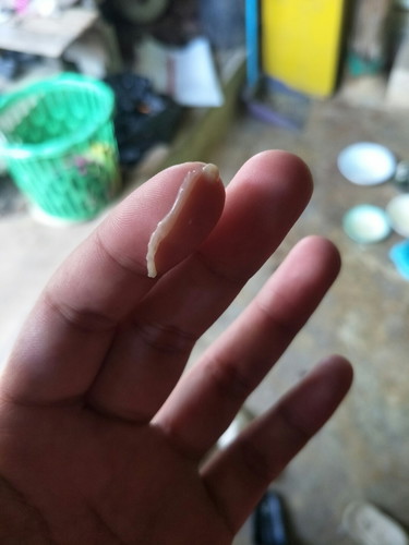 แบบนี้ ตกขาว หรือมูกค่ะ แต่ไม่มีอาการปวดท้อง 40วีค