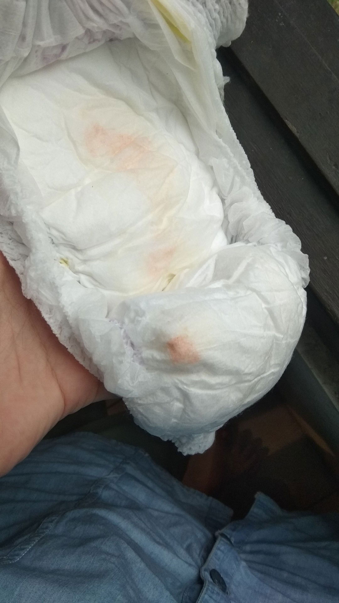 Bercak Pasa Popok Bayi