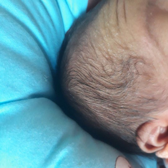 tham khảo cách chữa trị