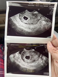 Worawan Bualuphan profile icon