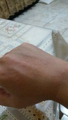 Gatal2 sejak kehamilan 3 bulan