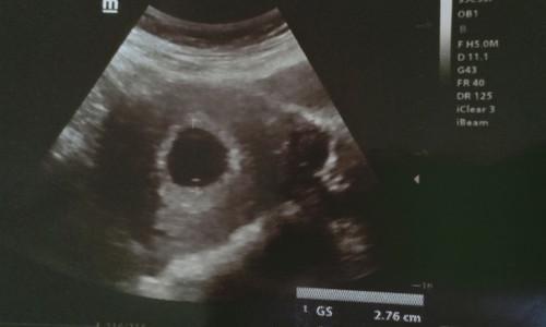 scan tak nampak.. hanya nmpak dot je..