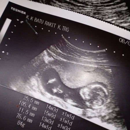 size kepala besar pada badan