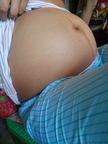 Boy or Girl?